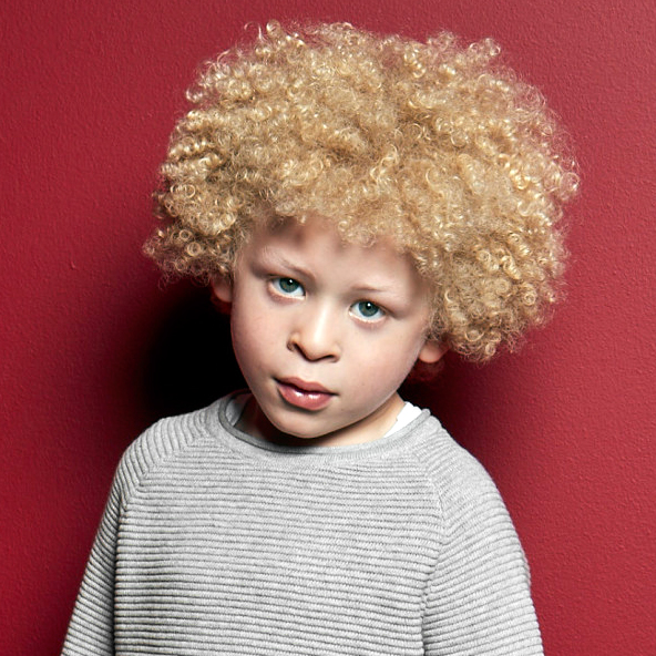 Un petit garçon albinos devient mannequin pour la campagne de publicité Primark